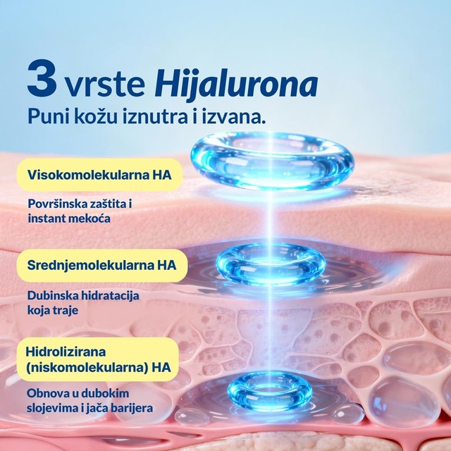 HIJALURONSKA-KISELINA-SLAJD